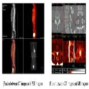 Medical Software : Vfusion